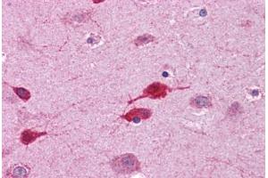Human Brain, Cortex: Formalin-Fixed, Paraffin-Embedded (FFPE) (WNT5A antibody  (AA 180-229))