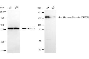 Western blotting analysis using mannose receptor (CD206) antibody (ABIN7799329). (Recombinant Mannose Receptor antibody)
