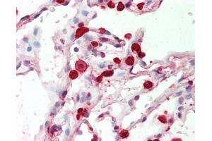Human Lung: Formalin-Fixed, Paraffin-Embedded (FFPE) (FABP5 antibody)