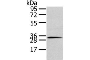 Gel: 10 % SDS-PAGE, Lysate: 80 μg, Lane: 231 cell, Primary antibody: ABIN7128026(STX19 Antibody) at dilution 1/800 dilution, Secondary antibody: Goat anti rabbit IgG at 1/8000 dilution, Exposure time: 10 seconds (Syntaxin 19 antibody)