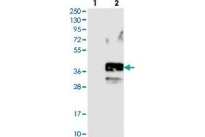 Western blot analysis of Lane 1: Negative control (vector only transfected HEK293T lysate). (SLC10A2 antibody)