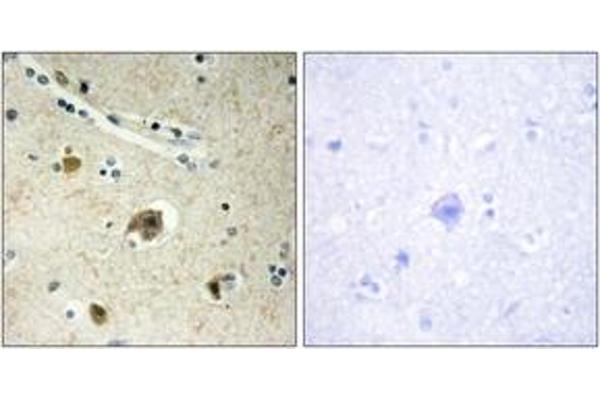 Col4a4 antibody  (AA 541-590)