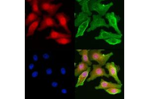 ABIN6261220 and ABIN6277828 staining Hela cells by IF/ICC.