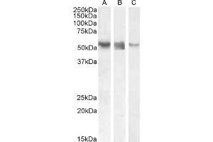Western Blotting (WB) image for anti-RAR-Related Orphan Receptor C (RORC) (AA 200-212) antibody (ABIN625825)