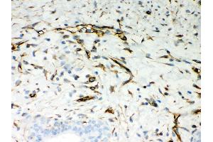 Immunohistochemistry (IHC) image for anti-Vimentin (VIM) (AA 435-466), (C-Term) antibody (ABIN3042344)