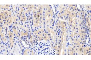 Detection of IL18 in Porcine Kidney Tissue using Polyclonal Antibody to Interleukin 18 (IL18) (IL-18 antibody  (AA 36-192))
