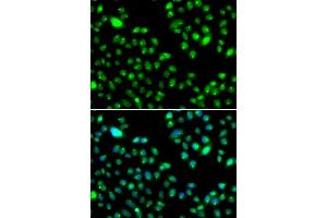 Immunofluorescence analysis of MCF-7 cells using L3MBTL3 antibody (ABIN4904189).