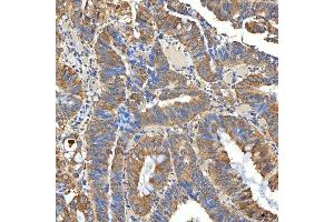 IHC analysis of SNPH using anti-SNPH antibody (ABIN7601724). (Syntaphilin antibody  (AA 43-482))