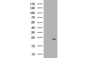 Western Blotting (WB) image for anti-Interferon-Induced Protein 35 (IFI35) antibody (ABIN1498799)