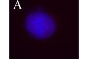 Image no. 3 for anti-Aurora Kinase B (AURKB) (pThr232) antibody (ABIN230502) (Aurora Kinase B antibody  (pThr232))