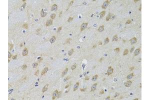 Immunohistochemistry of paraffin-embedded mouse brain using  Antibody (ABIN3022786, ABIN3022787, ABIN3022788 and ABIN6219229) at dilution of 1:100 (40x lens). (ADRBK2 antibody  (AA 1-300))
