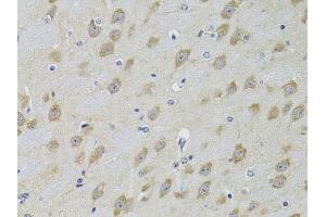 Immunohistochemistry of paraffin-embedded mouse brain using  Antibody (ABIN3022786, ABIN3022787, ABIN3022788 and ABIN6219229) at dilution of 1:100 (40x lens). (ADRBK2 antibody  (AA 1-300))