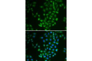 Immunofluorescence (IF) image for anti-Protein Kinase, CAMP Dependent, Catalytic, beta (PRKACB) antibody (ABIN1876512) (PRKACB antibody)