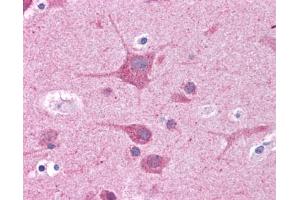 Immunohistochemistry (IHC) image for anti-RAR-Related Orphan Receptor C (RORC) (N-Term) antibody (ABIN2782284) (RORC antibody  (N-Term))