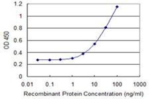 Detection limit for recombinant GST tagged SIK1 is 0. (SIK1 antibody  (AA 1-100))