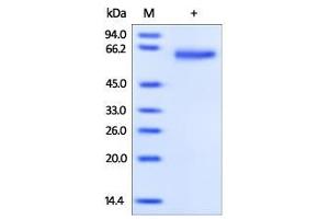 Human GFR alpha-1, His Tag on SDS-PAGE under reducing (R) condition. (GFRA1 Protein (AA 25-424) (His tag))