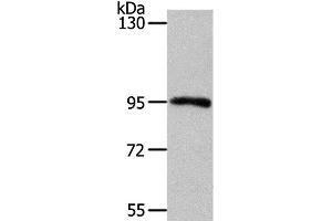 Western Blot analysis of Mouse kidney tissue using MYSM1 Polyclonal Antibody at dilution of 1:1100 (MYSM1 antibody)