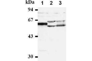 Western Blotting (WB) image for anti-Cell Division Cycle 25 Homolog A (S. Pombe) (CDC25A) antibody (ABIN487483) (CDC25A antibody)