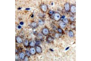Immunohistochemistry (IHC) image for anti-Retinol Binding Protein 2, Cellular (RBP2) antibody (ABIN7308264) (RBP2 antibody)