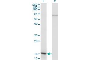 NFATC2IP antibody  (AA 1-138)