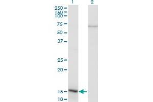 Western Blot analysis of NFATC2IP expression in transfected 293T cell line by NFATC2IP monoclonal antibody (M02), clone 3E9-B7. (NFATC2IP antibody  (AA 1-138))