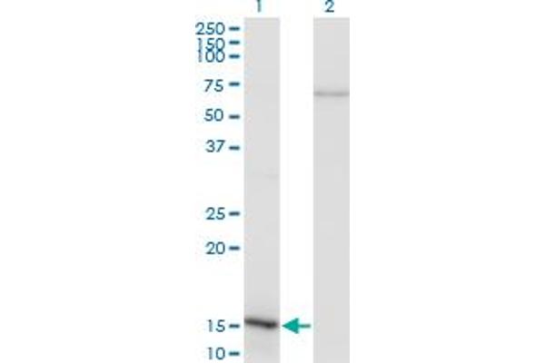 NFATC2IP 抗体  (AA 1-138)