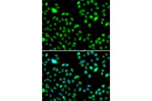 Immunofluorescence analysis of MCF7 cell using L3MBTL3 antibody.