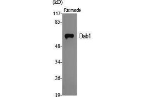 Western Blot (WB) analysis of specific cells using Dab1 Polyclonal Antibody. (DAB1 antibody  (Ser296))