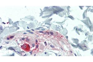 Immunohistochemistry of paraffin-embedded Colon, Submucosal Plexus tissue using TAC1 Polyclonal Antibody at dilution of 1:100. (TAC1 antibody)