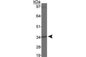 Western blot analysis of DLX4 in MDA-MB-231 cell lysates using DLX4 polyclonal antibody . (DLX4 antibody  (AA 1-60))