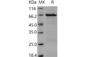 Western Blotting (WB) image for C-Src tyrosine Kinase (CSK) (Active) protein (GST tag) (ABIN7317088)