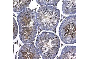 IHC testing of FFPE mouse testis tissue with GSTM3 antibody at 1ug/ml. (GSTM3 antibody)