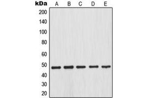 Western blot analysis of IKK beta (pS23) expression in HEK293T LPS-treated (A), SP2/0 LPS-treated (B), PC12 LPS-treated (C), HT29 (D), NIH3T3 TNFa-treated (E) whole cell lysates.
