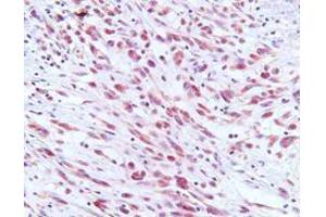 Immunohistochemistry (IHC) image for anti-Herpes Virus Type 8 (HHV8) (AA 122-329) antibody (ABIN371871)