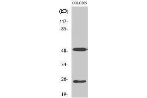 Western Blotting (WB) image for anti-Lecithin Retinol Acyltransferase (Phosphatidylcholine--Retinol O-Acyltransferase) (LRAT) (Internal Region) antibody (ABIN3180150) (LRAT antibody  (Internal Region))