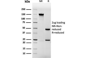 SDS-PAGE Analysis Purified Involucrin Mouse Recombinant Monoclonal Antibody (rIVRN/827). (Recombinant Involucrin antibody)