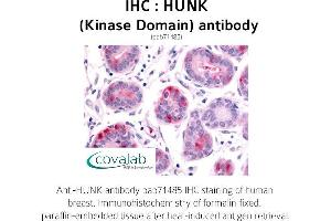 Image no. 1 for anti-Hormonally Up-Regulated Neu-Associated Kinase (HUNK) antibody (ABIN1735637) (HUNK antibody)