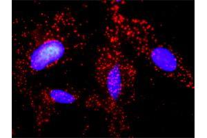 Proximity Ligation Analysis of protein-protein interactions between JUP and APC. (APC antibody  (AA 2744-2843))