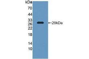 Detection of Recombinant LCP1, Human using Polyclonal Antibody to L-Plastin (LCP1) (LCP1 antibody  (AA 5-233))