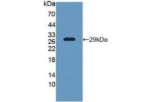 Detection of Recombinant LCP1, Human using Polyclonal Antibody to L-Plastin (LCP1)