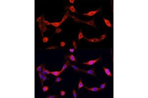 Immunofluorescence (IF) image for anti-Epidermal Growth Factor Receptor (EGFR) (AA 1021-1210) antibody (ABIN6139974)