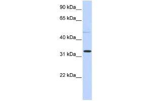 WB Suggested Anti-NEU4 Antibody Titration: 0. (Sialidase 4 antibody  (N-Term))