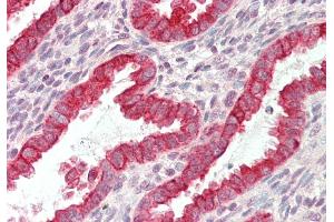 Rabbit Anti-KRT19 antibody  Formalin Fixed Paraffin Embedded Tissue: Human Uterus Primary antibody Concentration: 1:100 Secondary Antibody: Donkey anti-Rabbit-Cy3 Secondary Antibody Concentration: 1:200 Magnification: 20x Exposure Time: 0. (Cytokeratin 19 antibody  (N-Term))