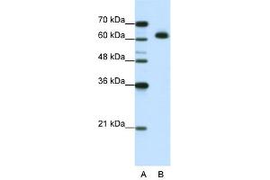 WB Suggested Anti-MGC42174 Antibody Titration:  1. (DIS3L2 antibody  (N-Term))