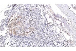 Detection of CD23 in Human Tonsil Tissue using Polyclonal Antibody to Cluster Of Differentiation 23 (CD23) (FCER2 antibody  (AA 151-321))