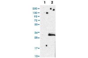 Western Blot (Cell lysate) analysis of (1) Negative control (vector only transfected HEK293T lysate), and (2) Over-expression lysate (Co-expressed with a C-terminal myc-DDK tag (~3. (CCDC134 antibody)