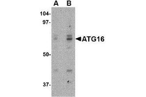 Western blot analysis of ATG16 in HeLa cell lysate with this product atG16 antibody at (A) 0. (ATG16L1 antibody  (Center))