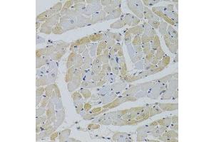 Immunohistochemistry of paraffin-embedded rat heart using GPD1 Antibody. (GPD1 antibody  (AA 1-349))