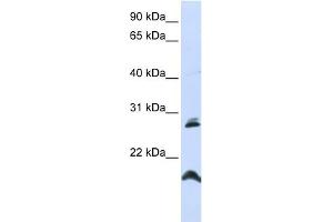 WB Suggested Anti-SPATA9 Antibody Titration:  0. (SPATA9 antibody  (N-Term))