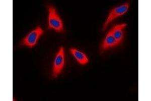 Immunofluorescent analysis of XPLN staining in MCF7 cells. (ARHGEF3 antibody  (C-Term))
